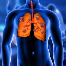 Respiratory Diseases